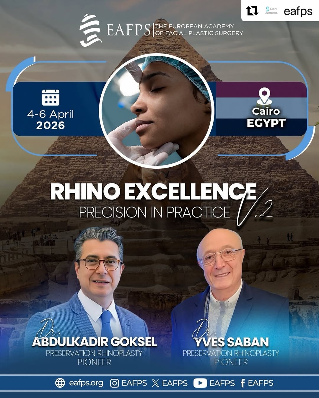 Rhino Excellence: Precision in Practice